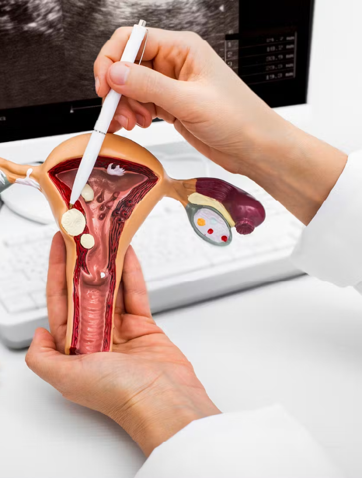 Gynocology Specialist